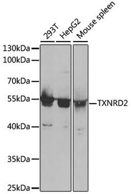 Western blot - TXNRD2 antibody (A5490)