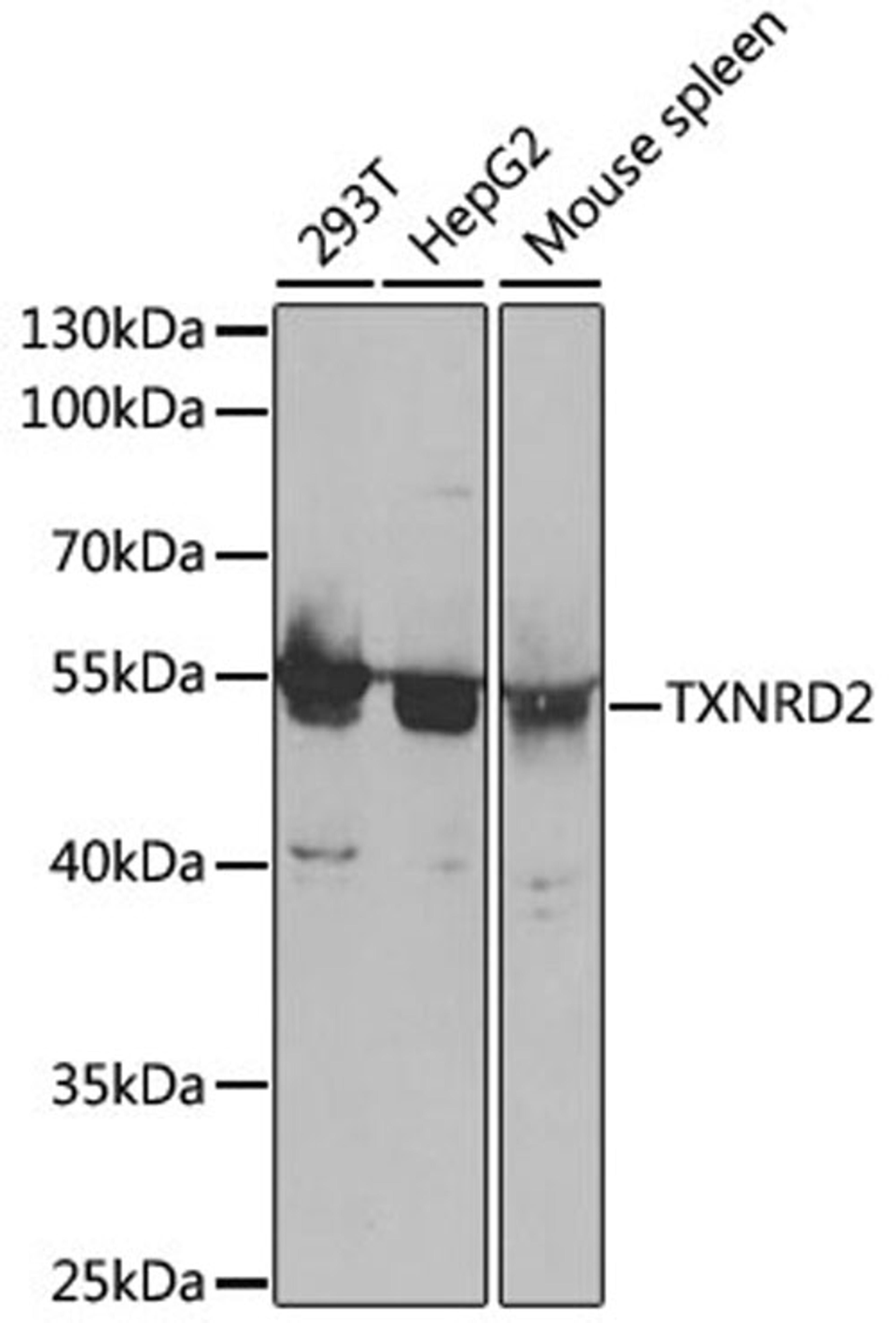 Western blot - TXNRD2 antibody (A5490)