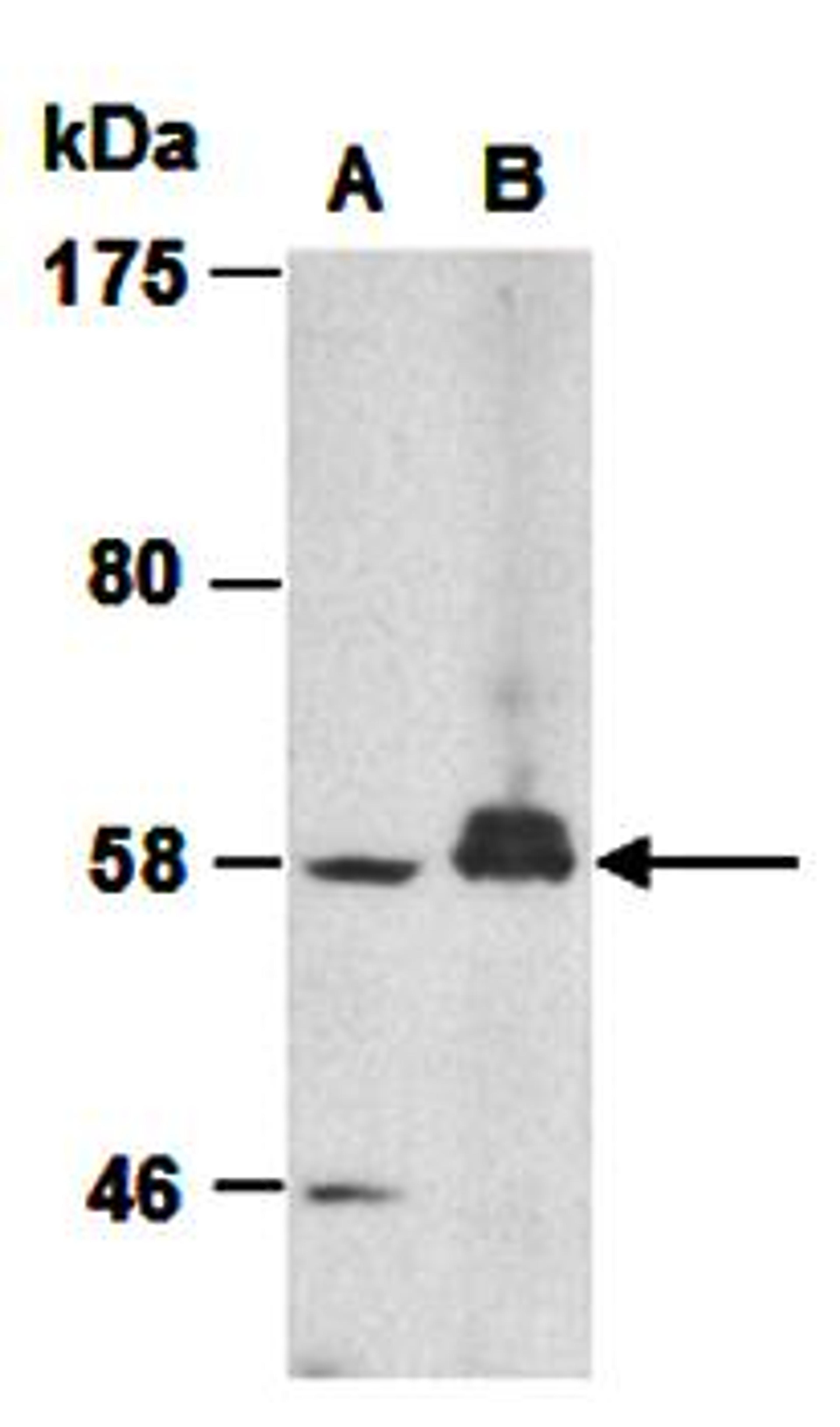 Western blot analysis of total cell extracts from mouse liver(Lane1) and human HepG2(Lane2) using SLC11A1 antibody