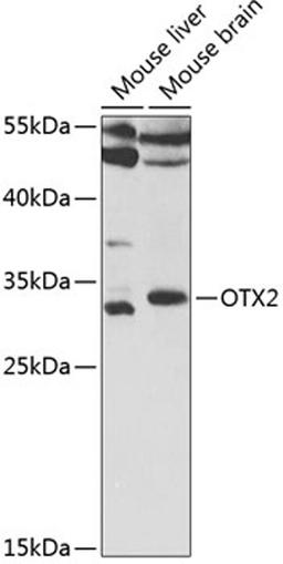 Western blot - OTX2 antibody (A5475)