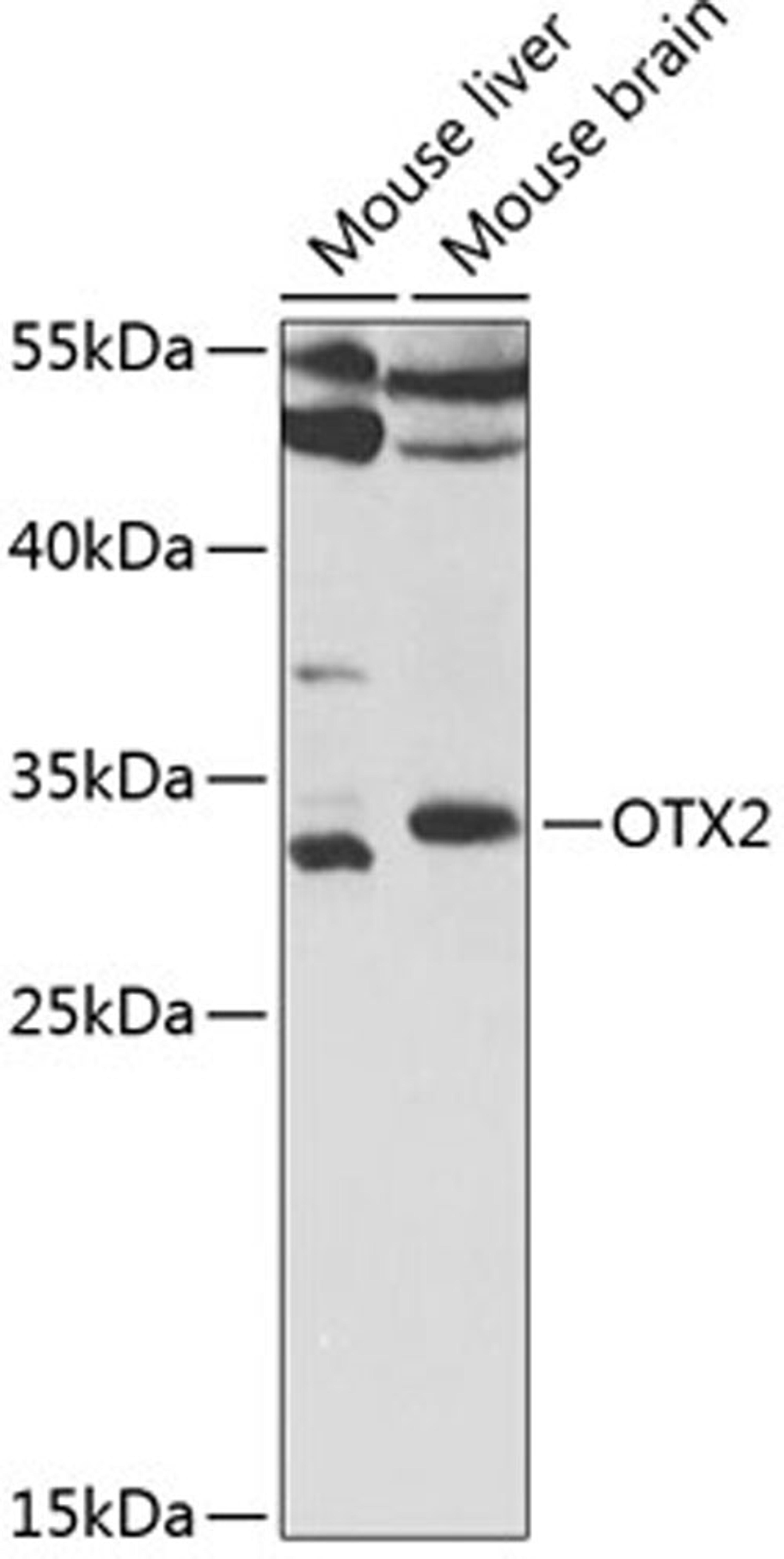 Western blot - OTX2 antibody (A5475)