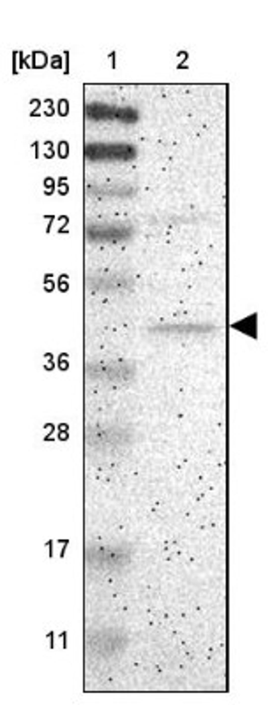 Western Blot: Centaurin alpha 1 Antibody [NBP1-88097] - Lane 1: Marker [kDa] 230, 130, 95, 72, 56, 36, 28, 17, 11<br/>Lane 2: Human cell line RT-4