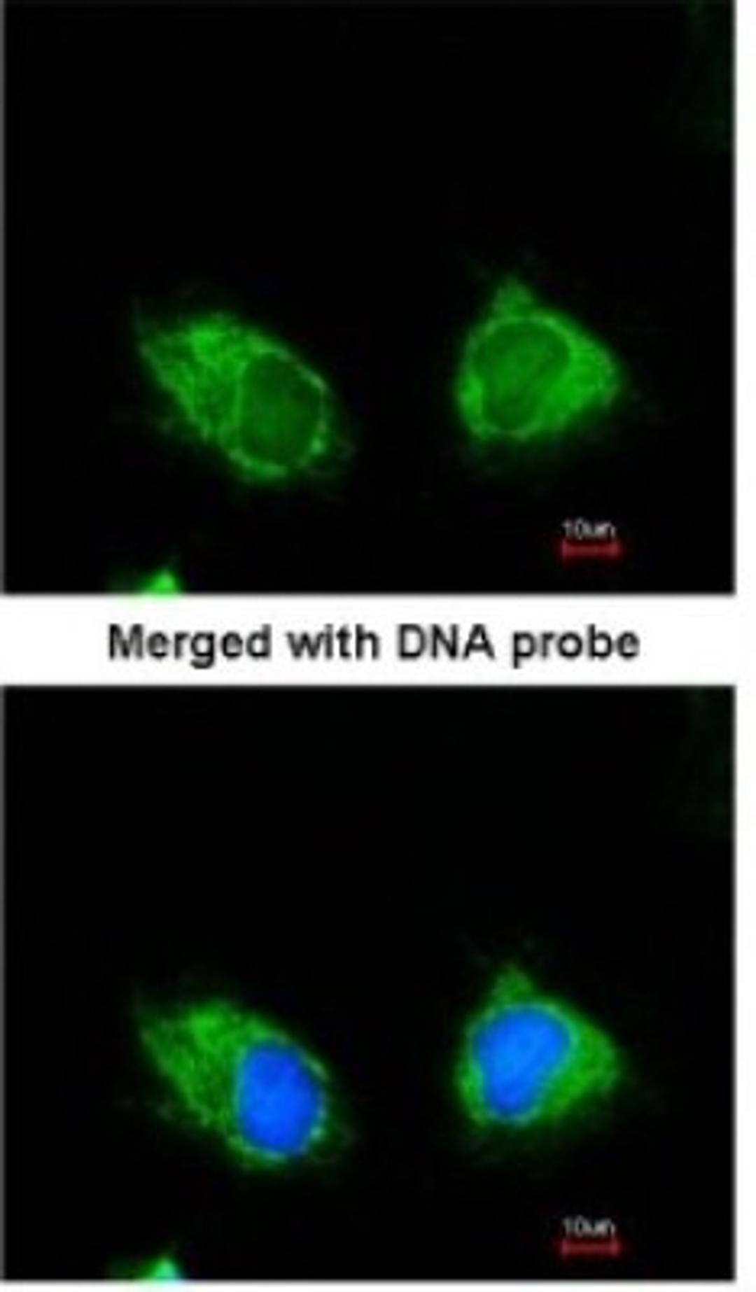 Immunocytochemistry/Immunofluorescence: INPP1 Antibody [NBP1-31475] - Paraformaldehyde-fixed HeLa, using antibody at 1:200 dilution.