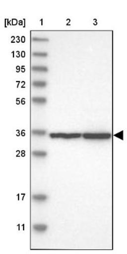 Western Blot: PCBP3 Antibody [NBP1-89505] - Lane 1: Marker [kDa] 230, 130, 95, 72, 56, 36, 28, 17, 11<br/>Lane 2: Human cell line RT-4<br/>Lane 3: Human cell line U-251MG sp