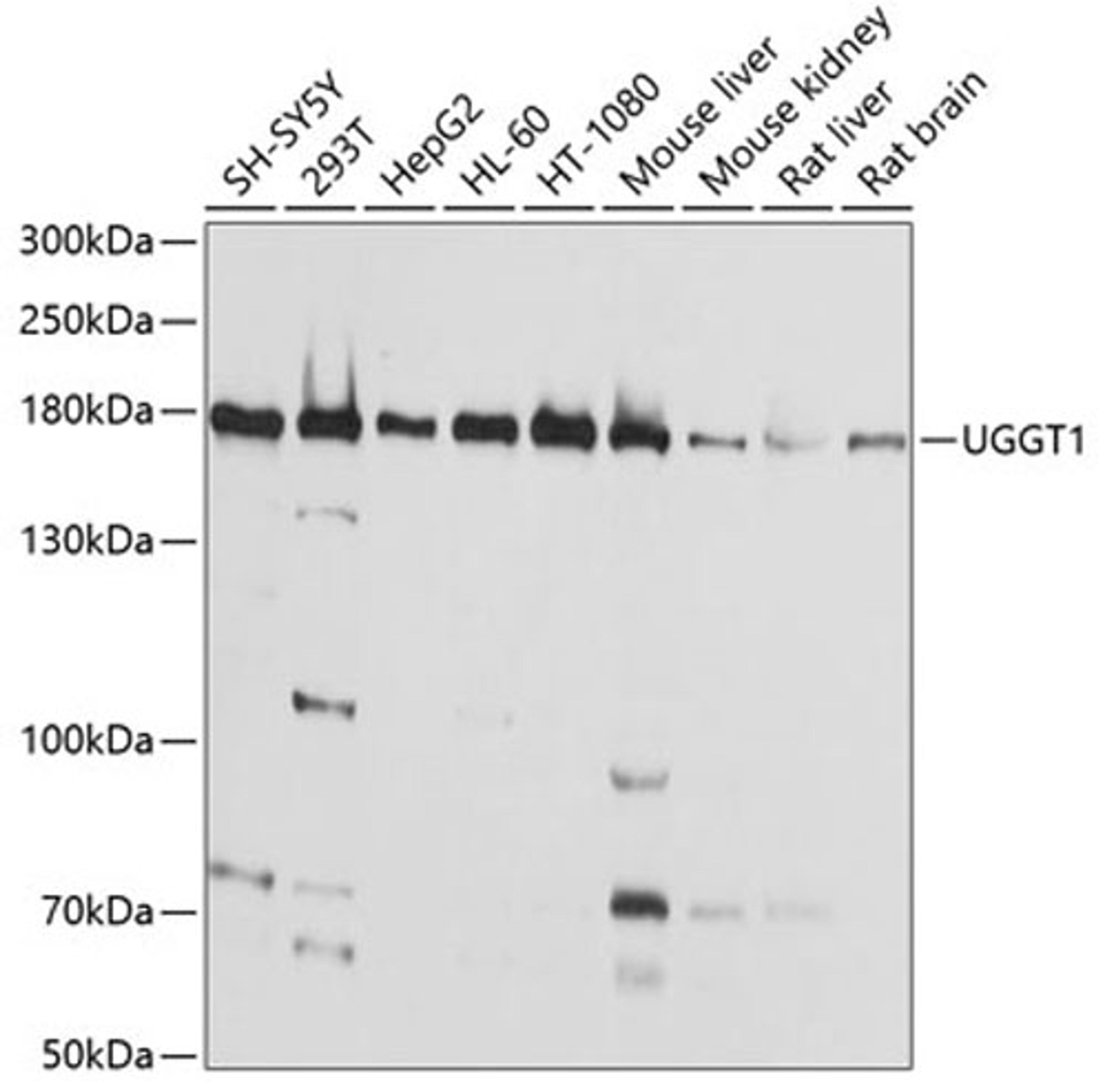 Western blot - UGGT1 antibody (A4866)