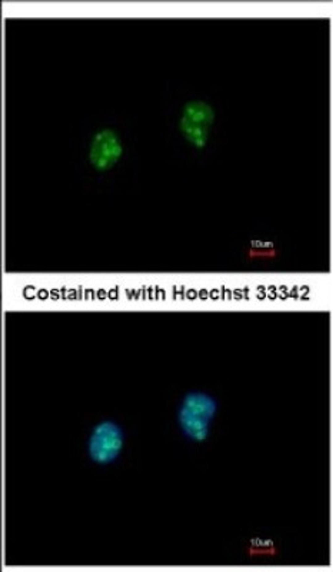 Immunocytochemistry/Immunofluorescence: ISG20 Antibody [NBP2-16996] - Immunofluorescence analysis of paraformaldehyde-fixed HeLa, using antibody at 1:500 dilution.