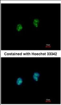 Immunocytochemistry/Immunofluorescence: ISG20 Antibody [NBP2-16996] - Immunofluorescence analysis of paraformaldehyde-fixed HeLa, using antibody at 1:500 dilution.