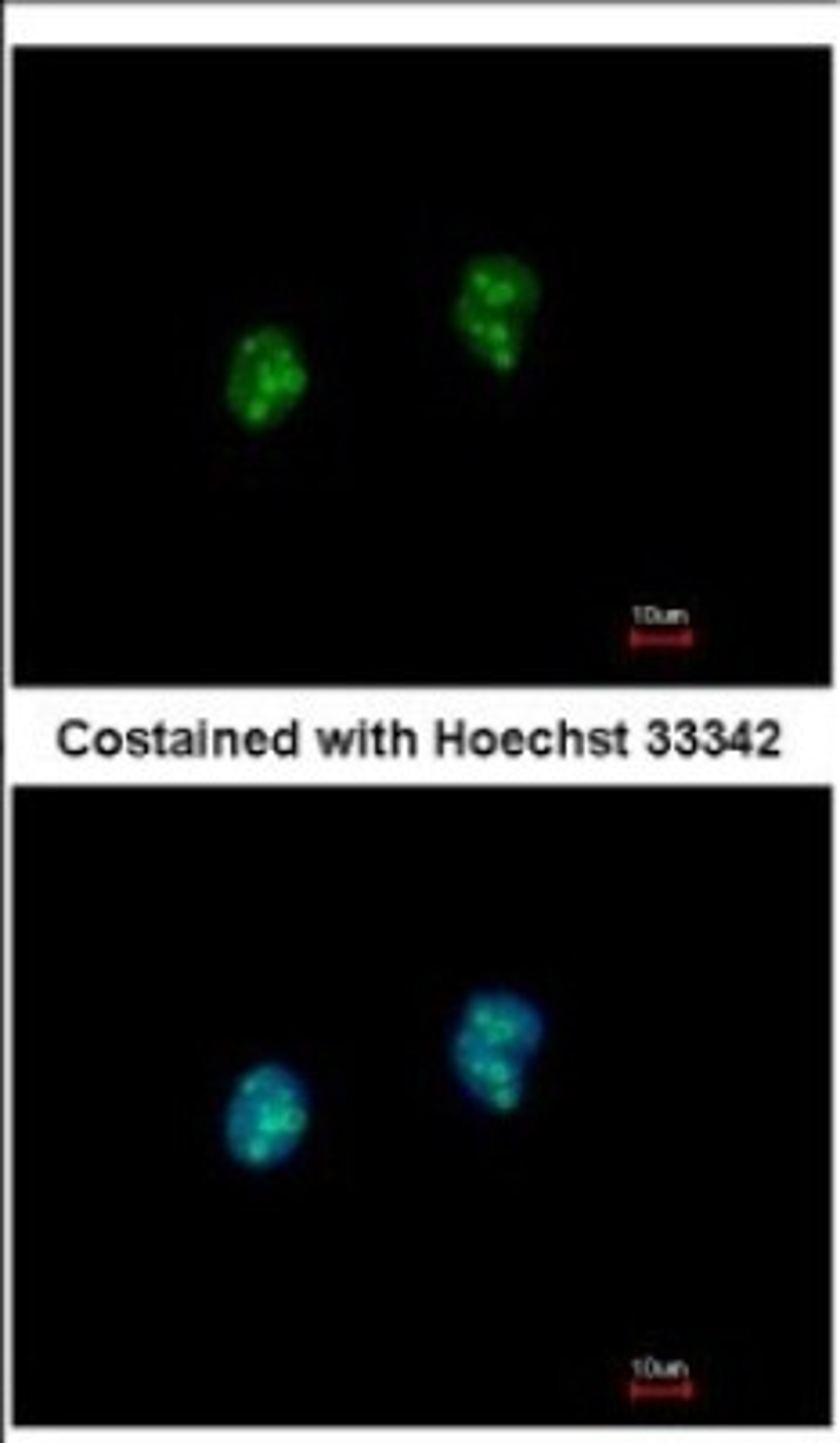 Immunocytochemistry/Immunofluorescence: ISG20 Antibody [NBP2-16996] - Immunofluorescence analysis of paraformaldehyde-fixed HeLa, using antibody at 1:500 dilution.