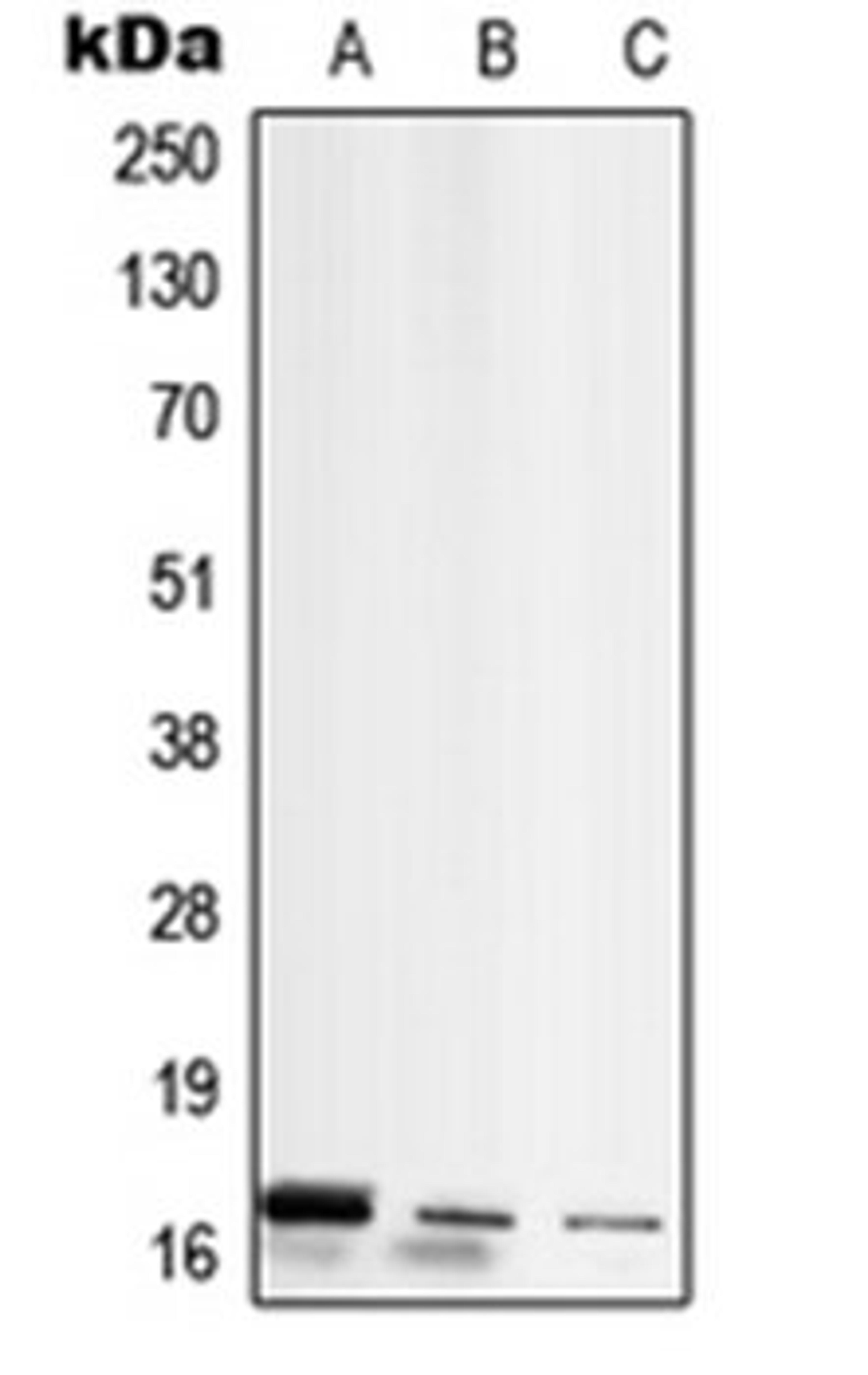 Western blot analysis of MCF7 (Lane 1), Raw264.7 (Lane 2), rat kidney (Lane 3) whole cell lysates using RPL26L1 antibody