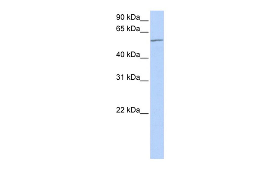 Antibody used in WB on Human HeLa at 0.2-1 ug/ml.