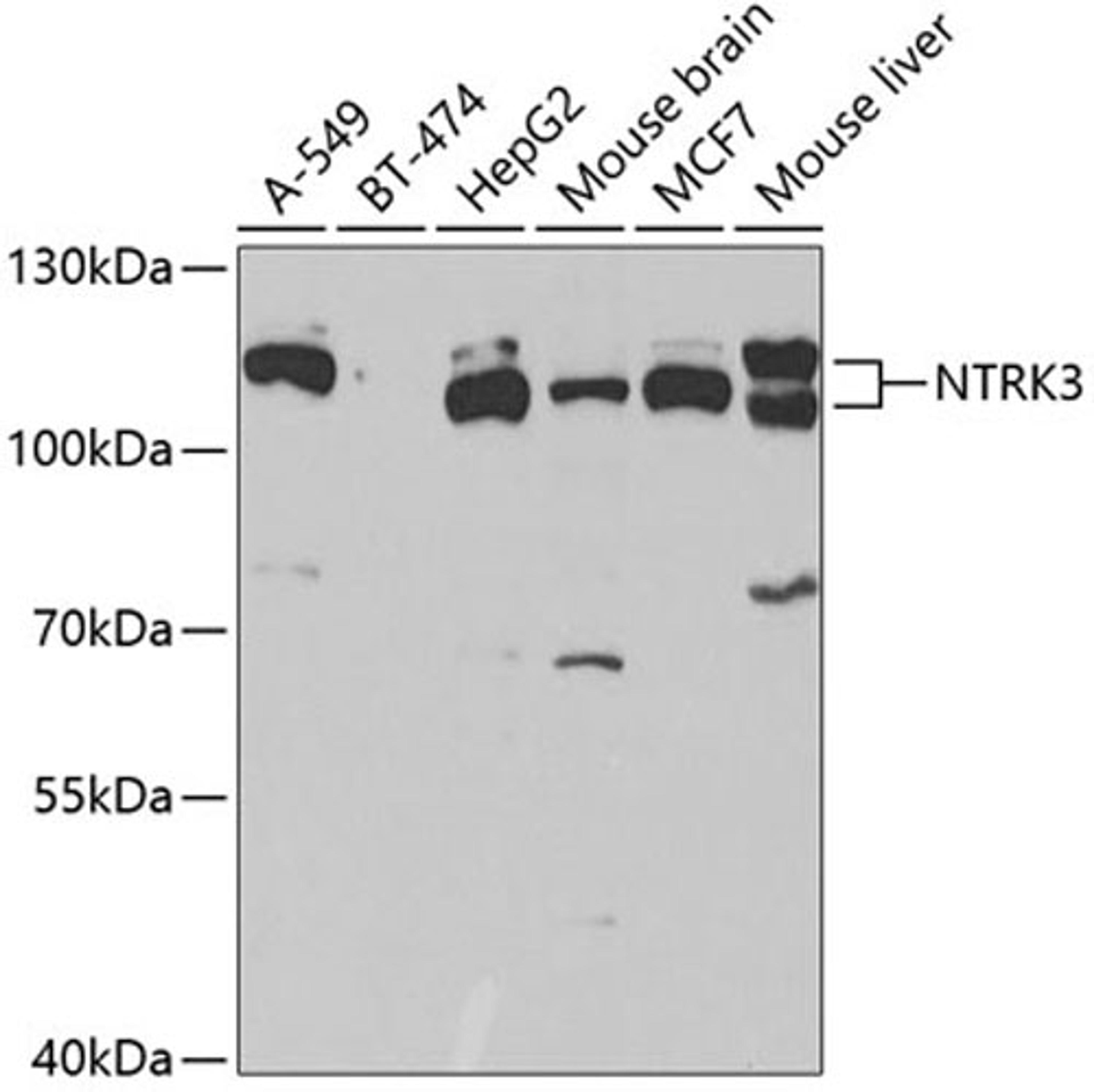 Western blot - NTRK3 antibody (A5842)