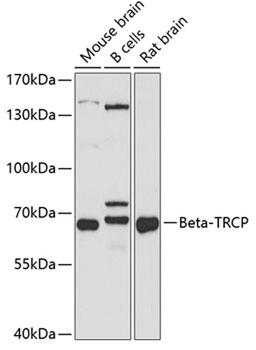 Western blot - Beta-TRCP antibody (A1656)