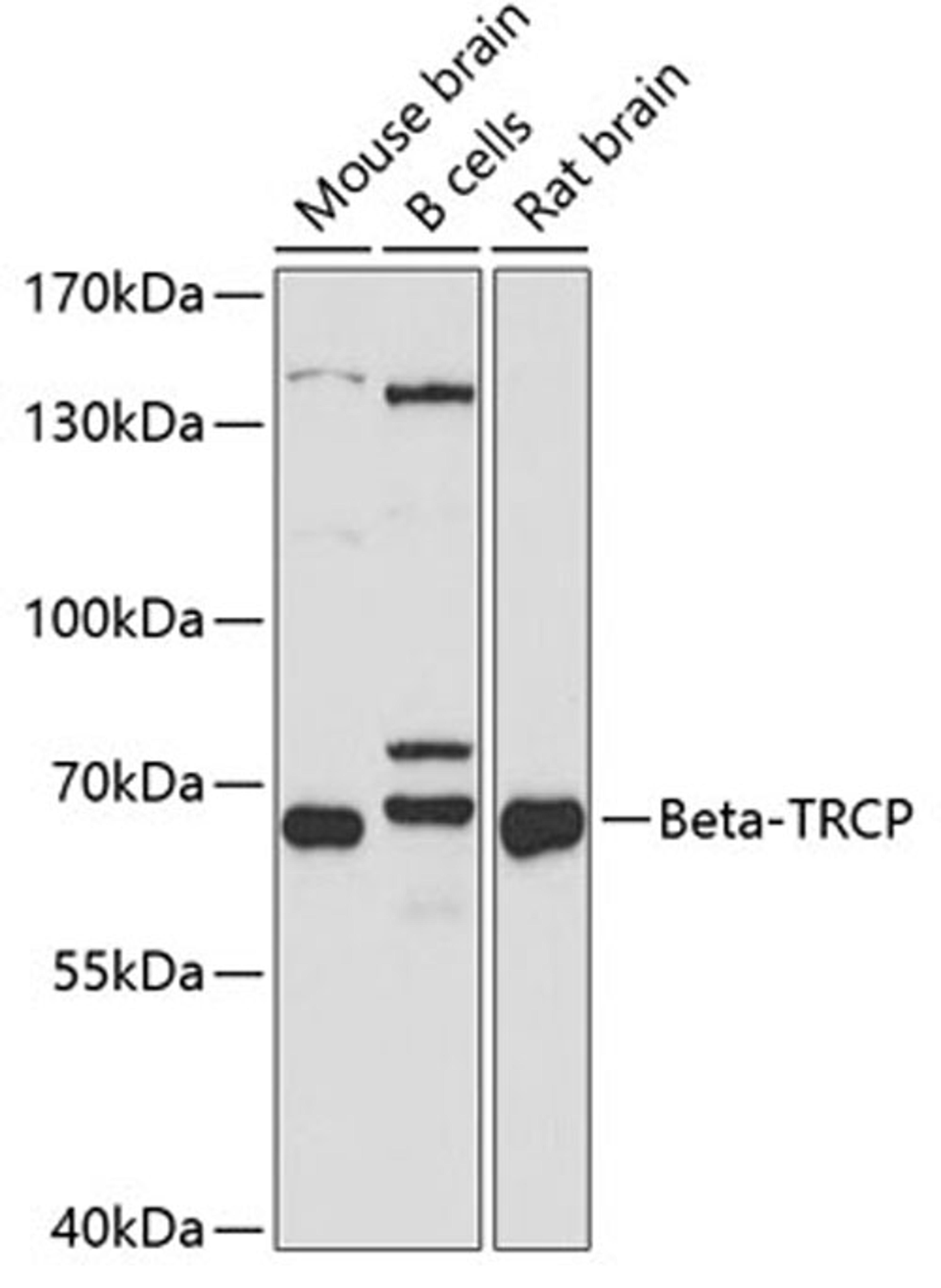 Western blot - Beta-TRCP antibody (A1656)