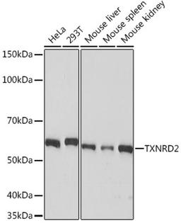 Western blot - TXNRD2 Rabbit mAb (A8884)