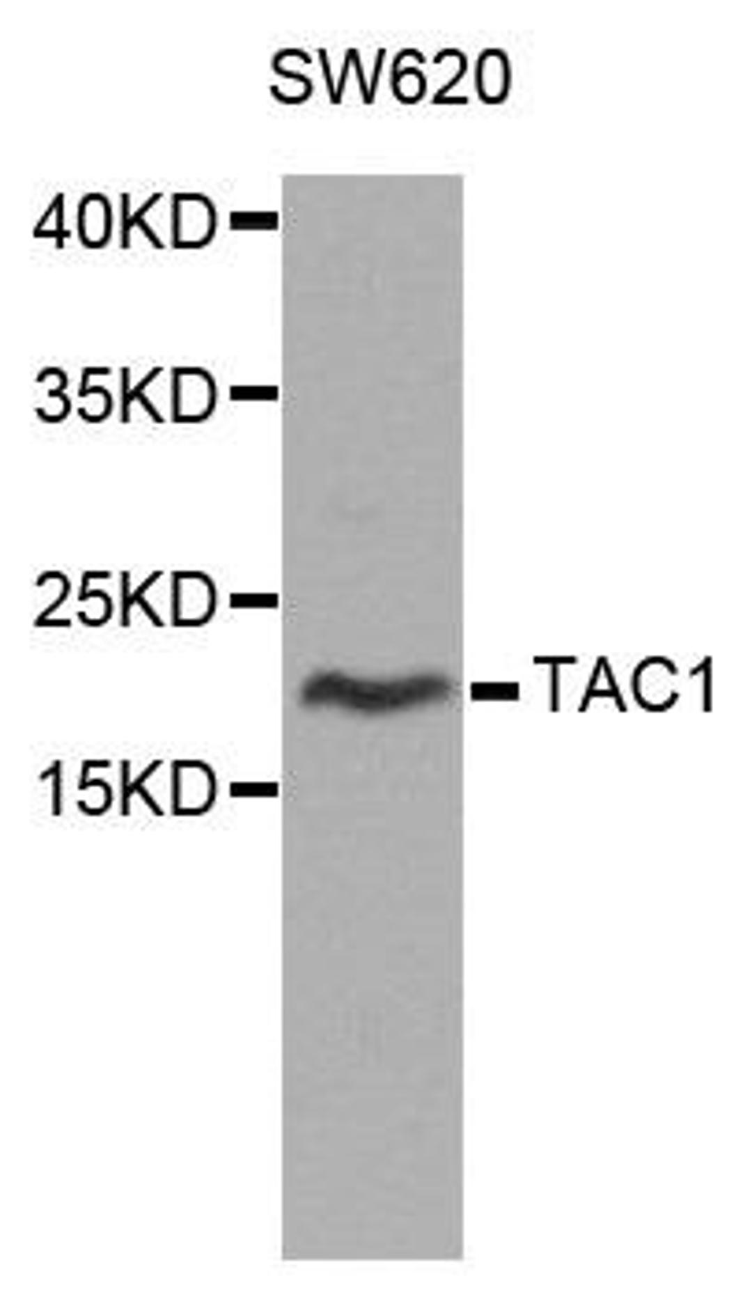 Western blot analysis of extracts of SW620 cells using TAC1 antibody