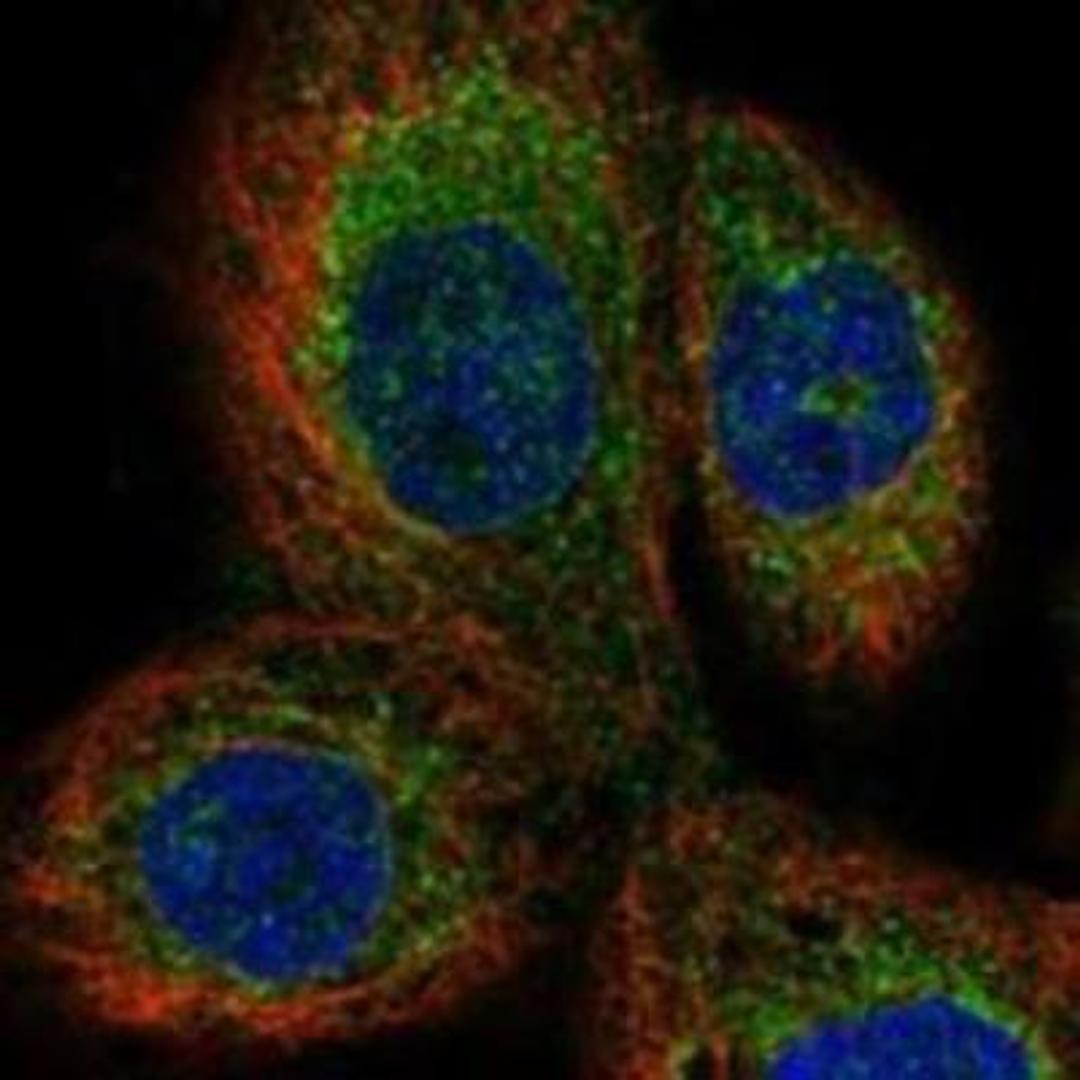 Immunocytochemistry/Immunofluorescence: DHRS4 Antibody [NBP1-83790] - Staining of human cell line A-431 shows positivity in nuclear membrane & vesicles.