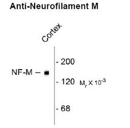 Western blot of rat cortex lysate showing specific immunolableing of the ~ 145k NF-M protein.