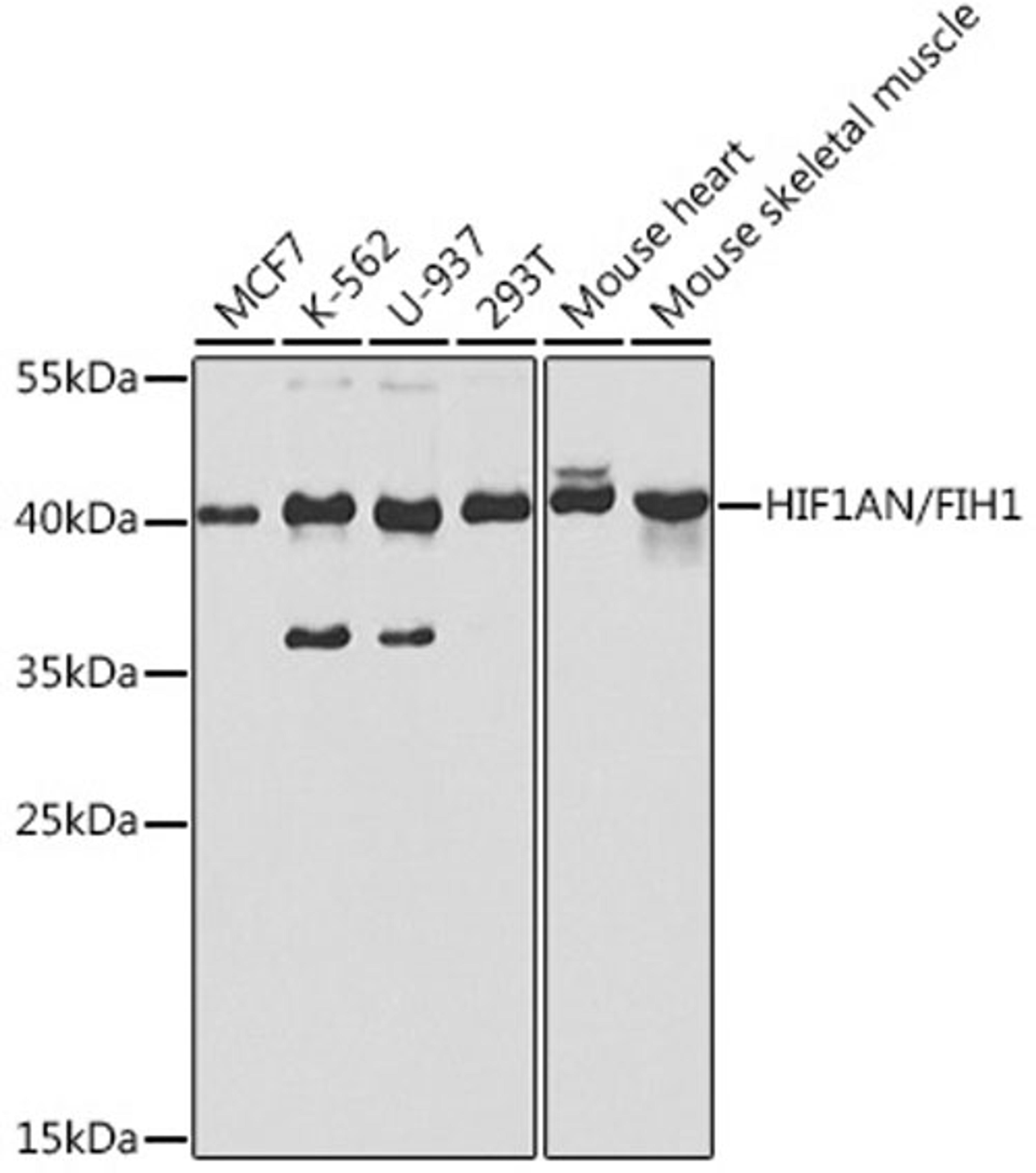 Western blot - HIF1AN/FIH1 antibody (A5466)