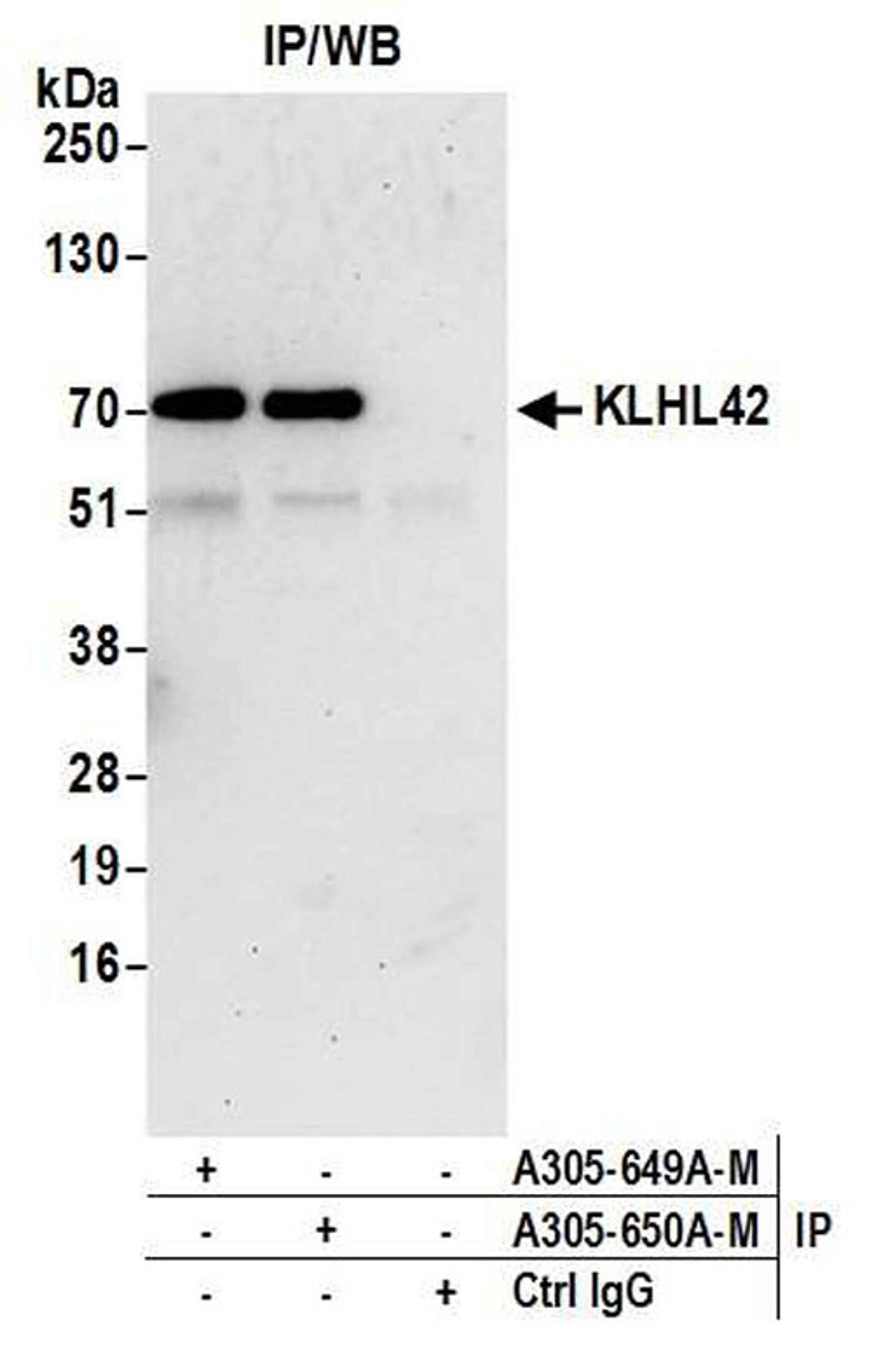 Detection of human KLHL42 by WB of IP.