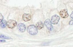 Detection of human XPF/ERCC4 by immunohistochemistry.