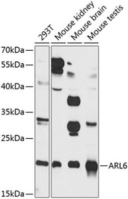 Western blot - ARL6 antibody (A8269)