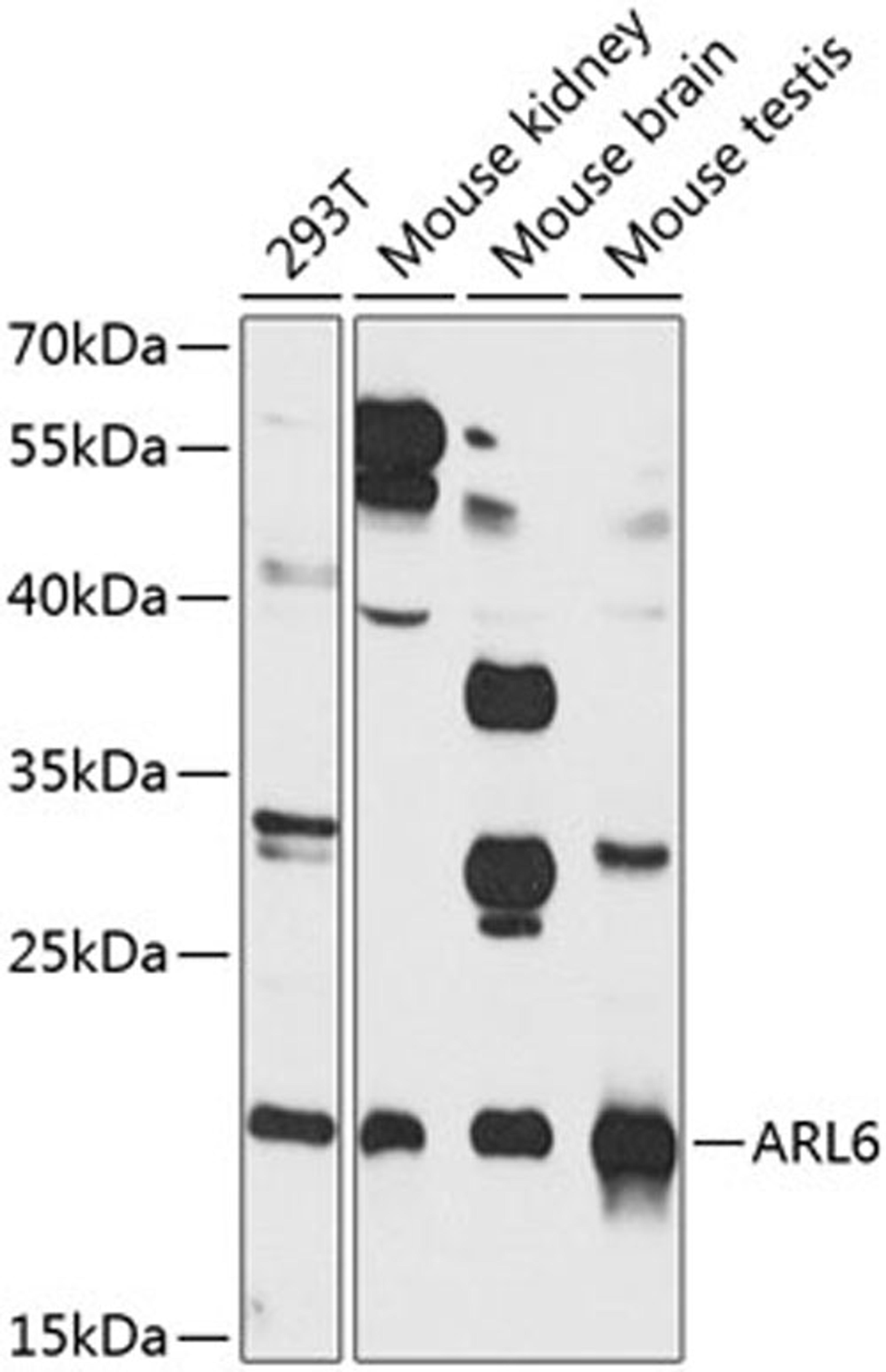 Western blot - ARL6 antibody (A8269)