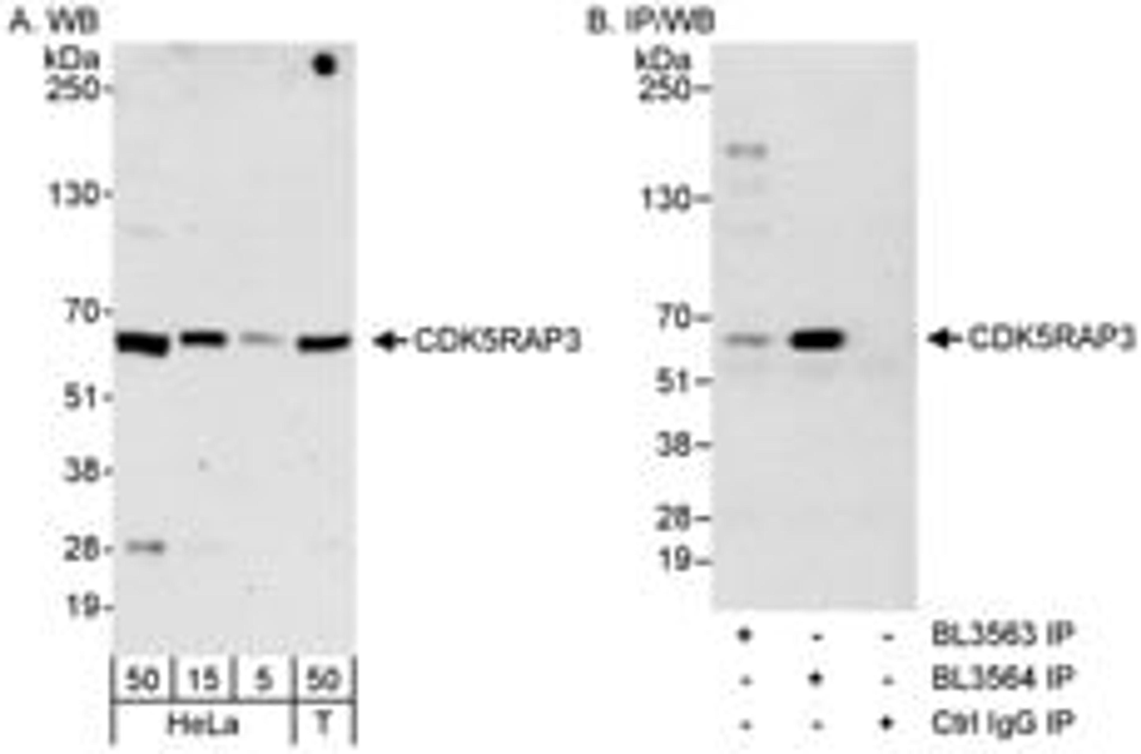 Detection of human CDK5RAP3 by western blot and immunoprecipitation.