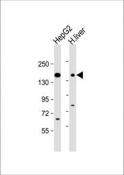 Western Blot at 1:1000 dilution Lane 1: HepG2 whole cell lysate Lane 2: human liver lysate Lysates/proteins at 20 ug per lane.