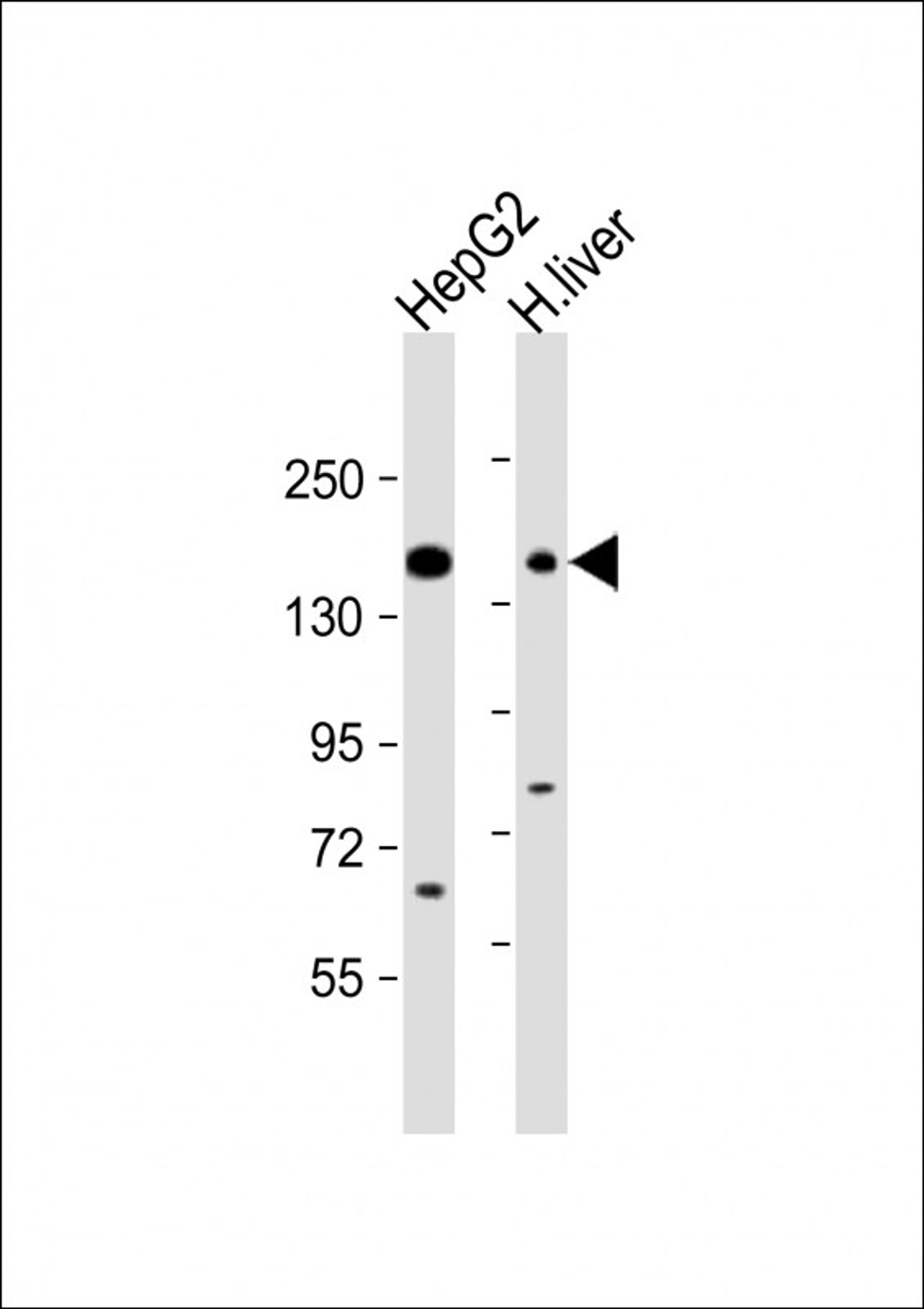 Western Blot at 1:1000 dilution Lane 1: HepG2 whole cell lysate Lane 2: human liver lysate Lysates/proteins at 20 ug per lane.