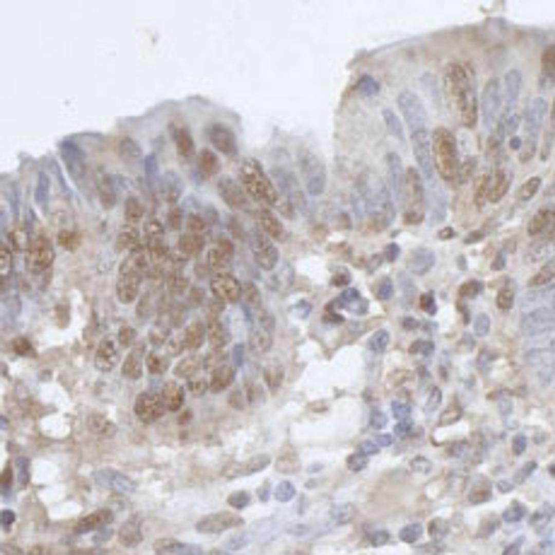 Detection of human CPSF68 by immunohistochemistry.