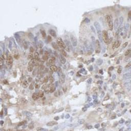 Detection of human CPSF68 by immunohistochemistry.