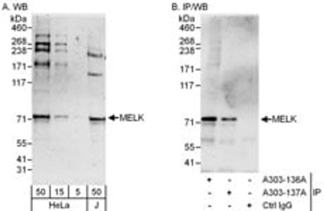 Detection of human MELK by western blot and immunoprecipitation.