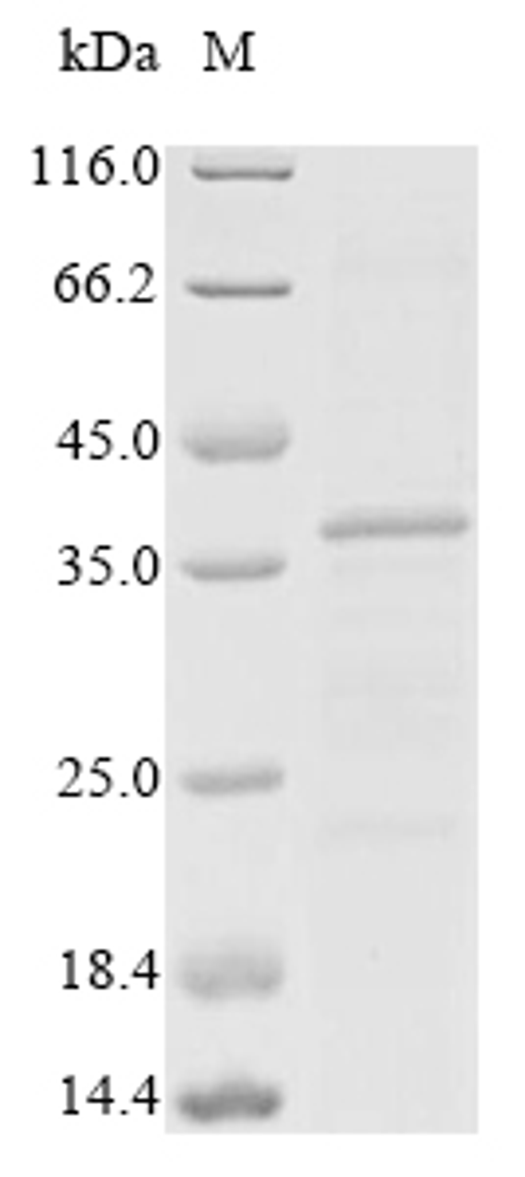 (Tris-Glycine gel) Discontinuous SDS-PAGE (reduced) with 5% enrichment gel and 15% separation gel.