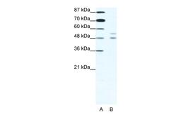 Antibody used in WB on Human HepG2 at 1.25 ug/ml.