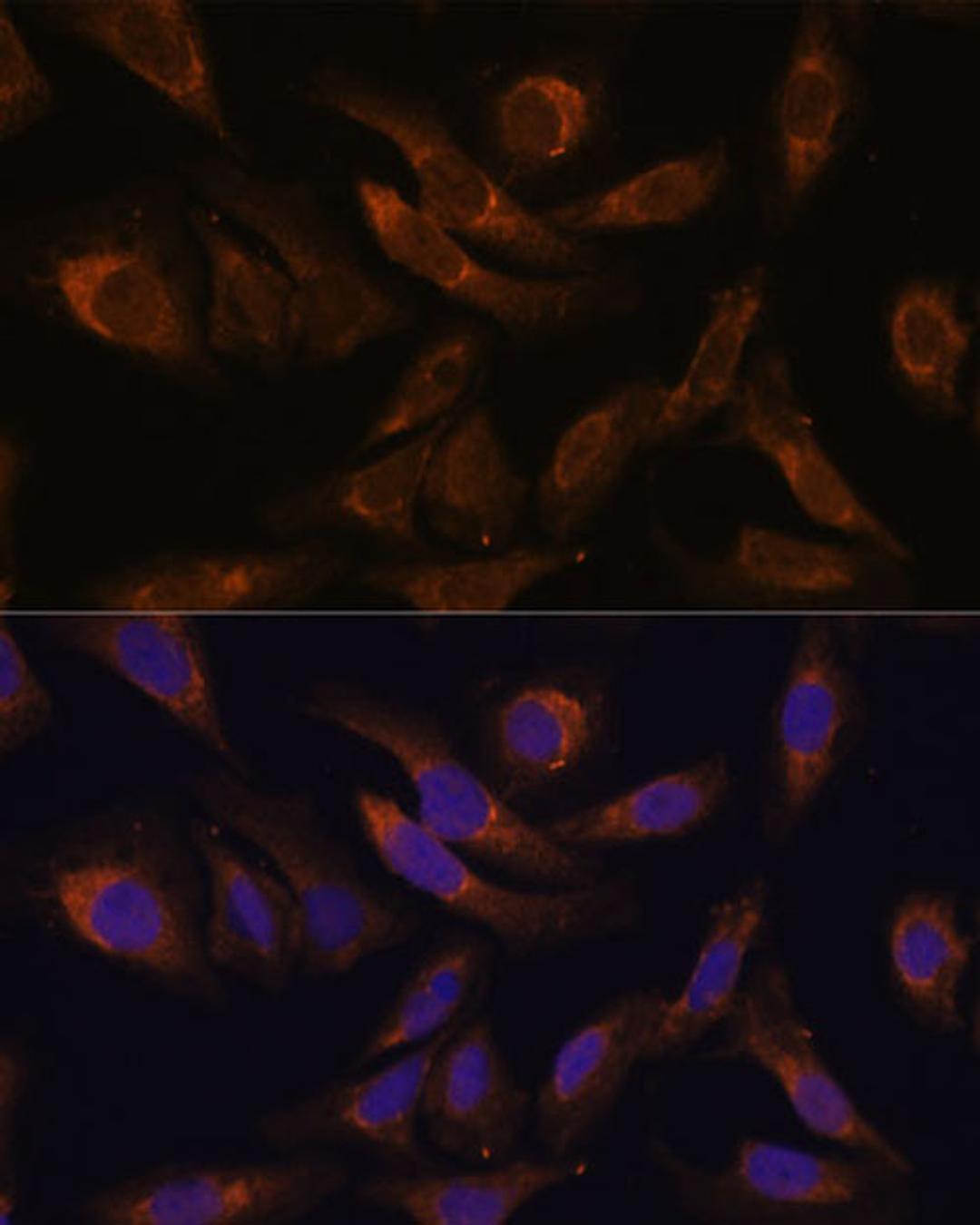 Immunofluorescence - SOCS2 Polyclonal Antibody (A17035)