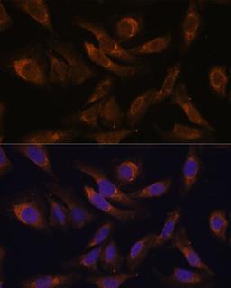 Immunofluorescence - SOCS2 Polyclonal Antibody (A17035)