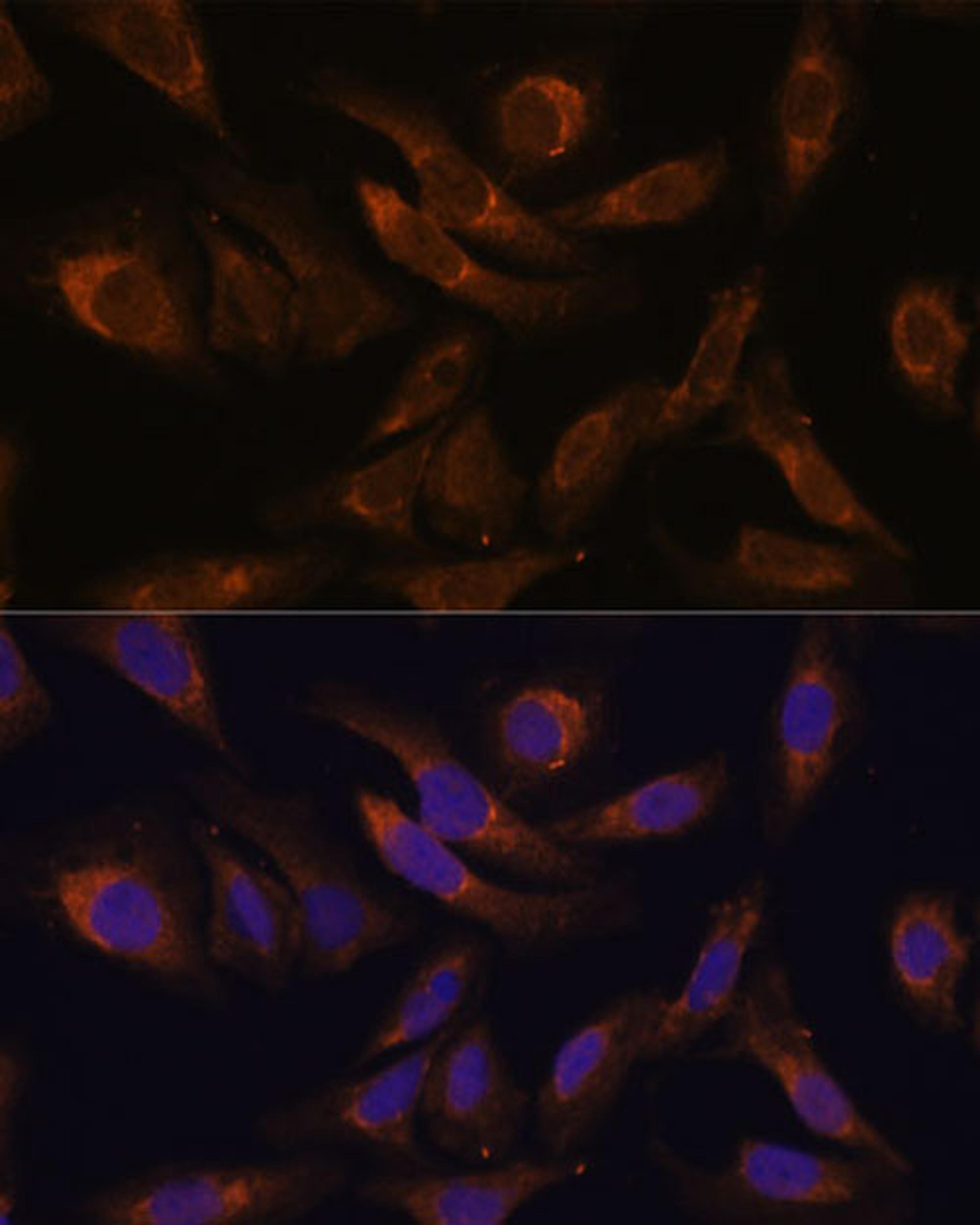 Immunofluorescence - SOCS2 Polyclonal Antibody (A17035)