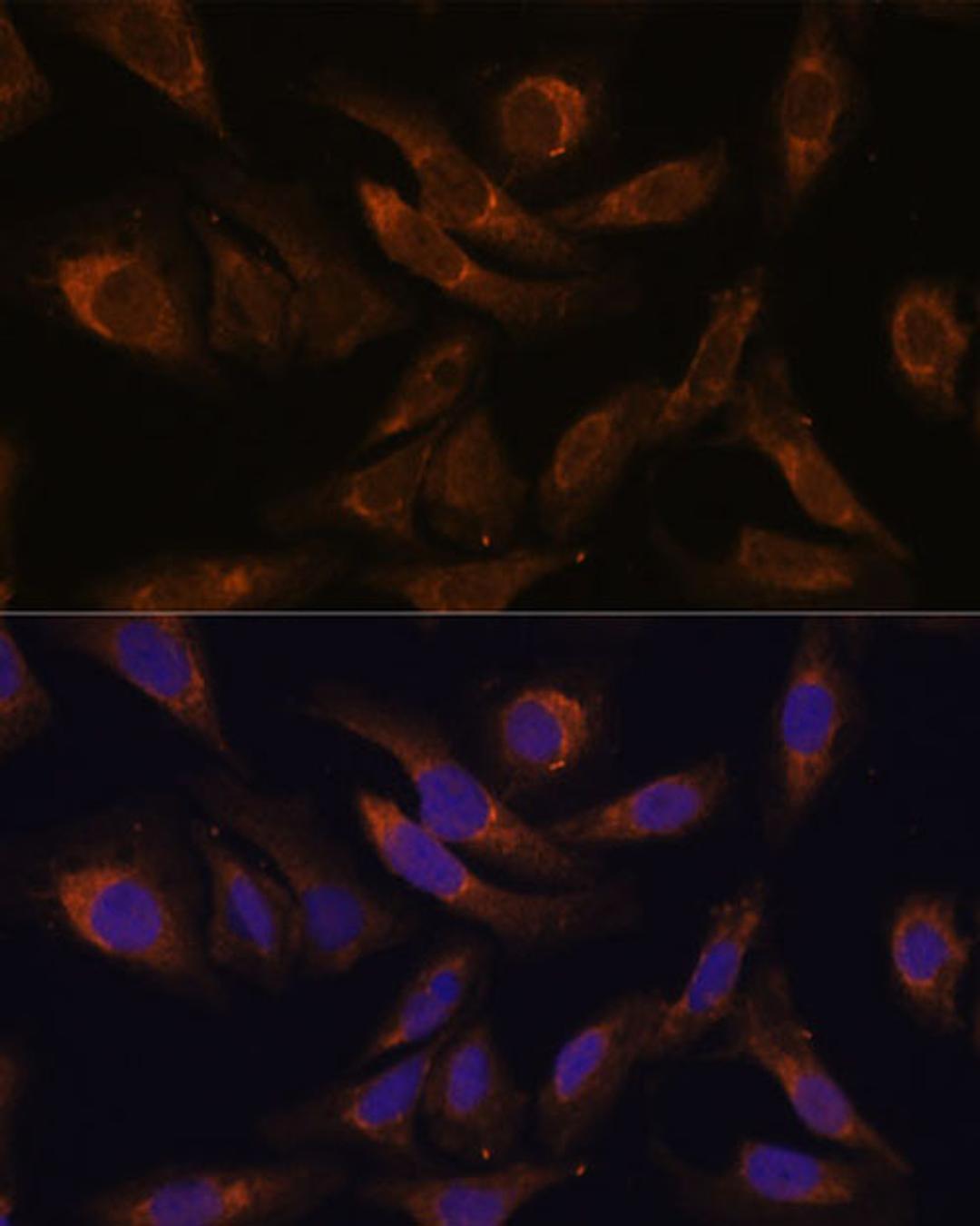 Immunofluorescence - SOCS2 Polyclonal Antibody (A17035)
