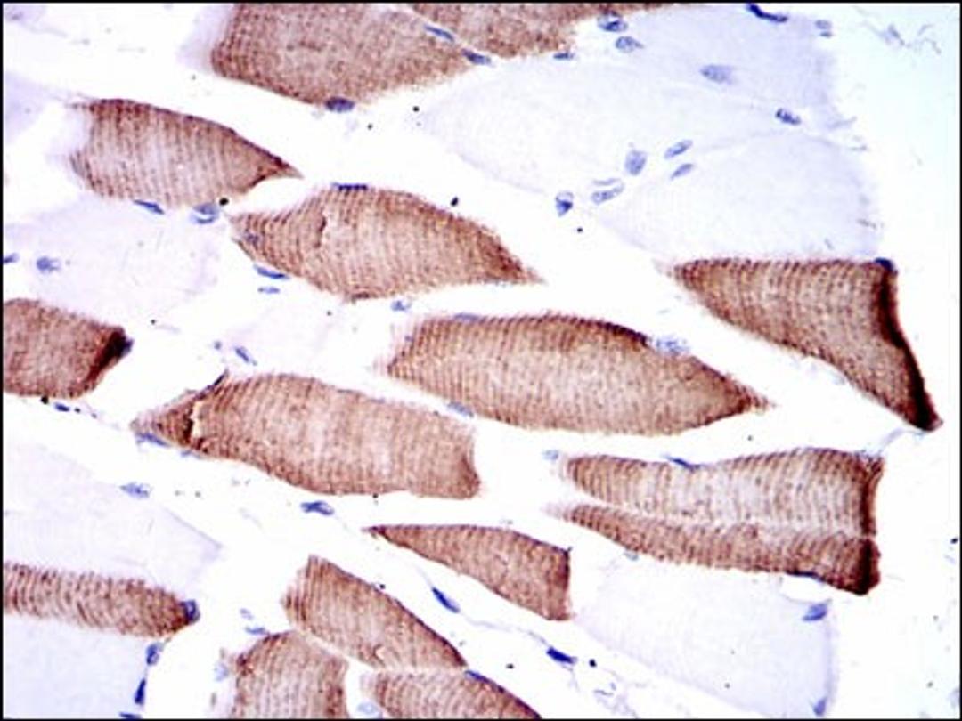 Immunohistochemistry: MKK7/MEK7 Antibody (4E5) [NBP2-37542] - Immunohistochemical analysis of paraffin-embedded muscle tissues using MAP2K7 mouse mAb with DAB staining.