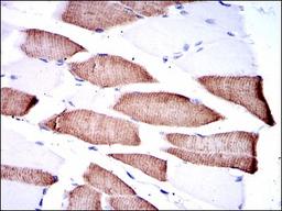 Immunohistochemistry: MKK7/MEK7 Antibody (4E5) [NBP2-37542] - Immunohistochemical analysis of paraffin-embedded muscle tissues using MAP2K7 mouse mAb with DAB staining.