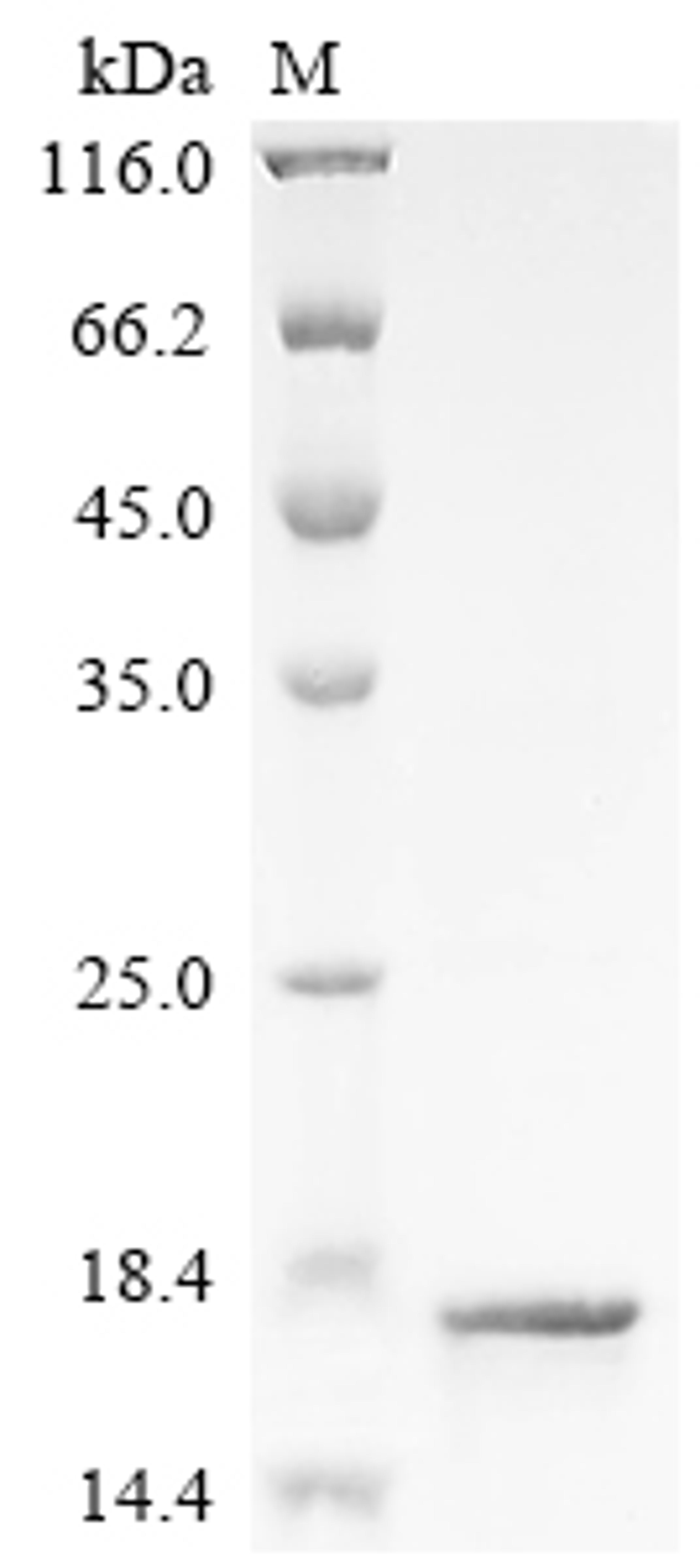 (Tris-Glycine gel) Discontinuous SDS-PAGE (reduced) with 5% enrichment gel and 15% separation gel.