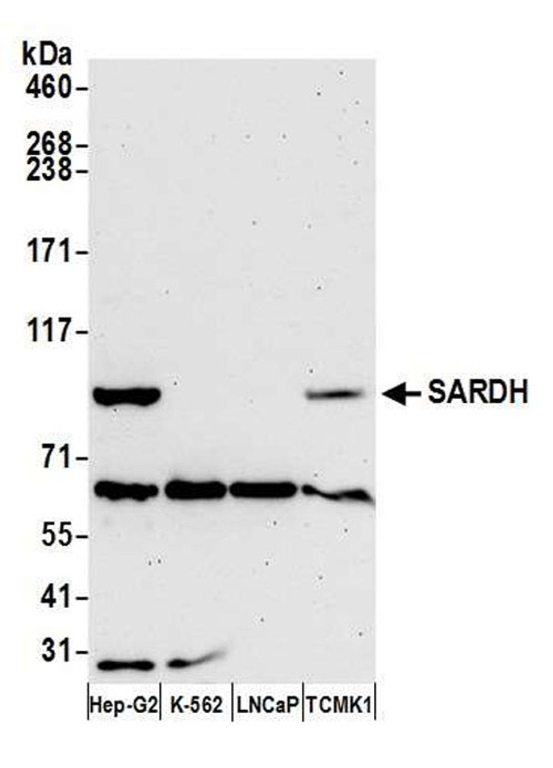 Detection of human and mouse SARDH by WB.