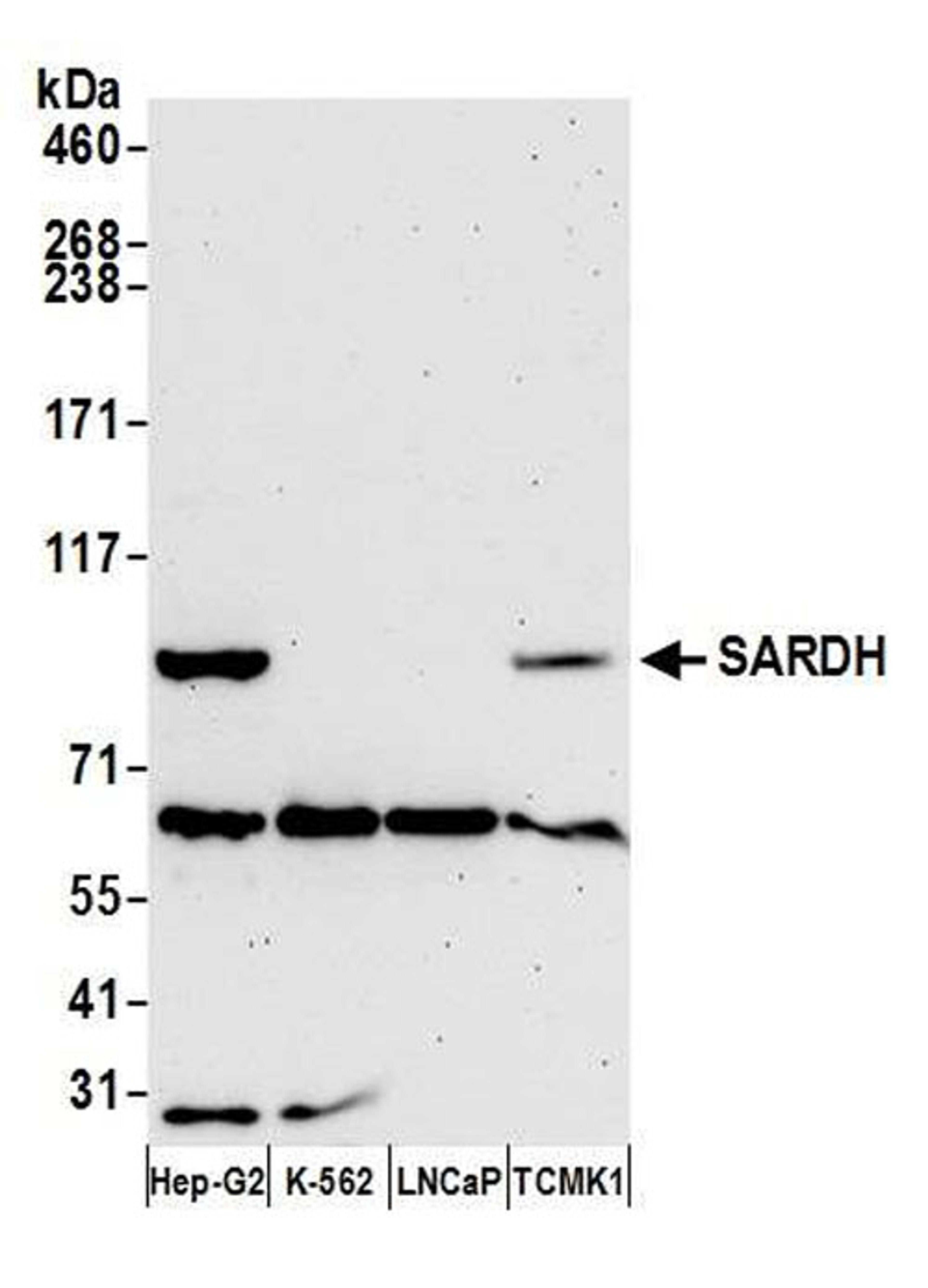 Detection of human and mouse SARDH by WB.