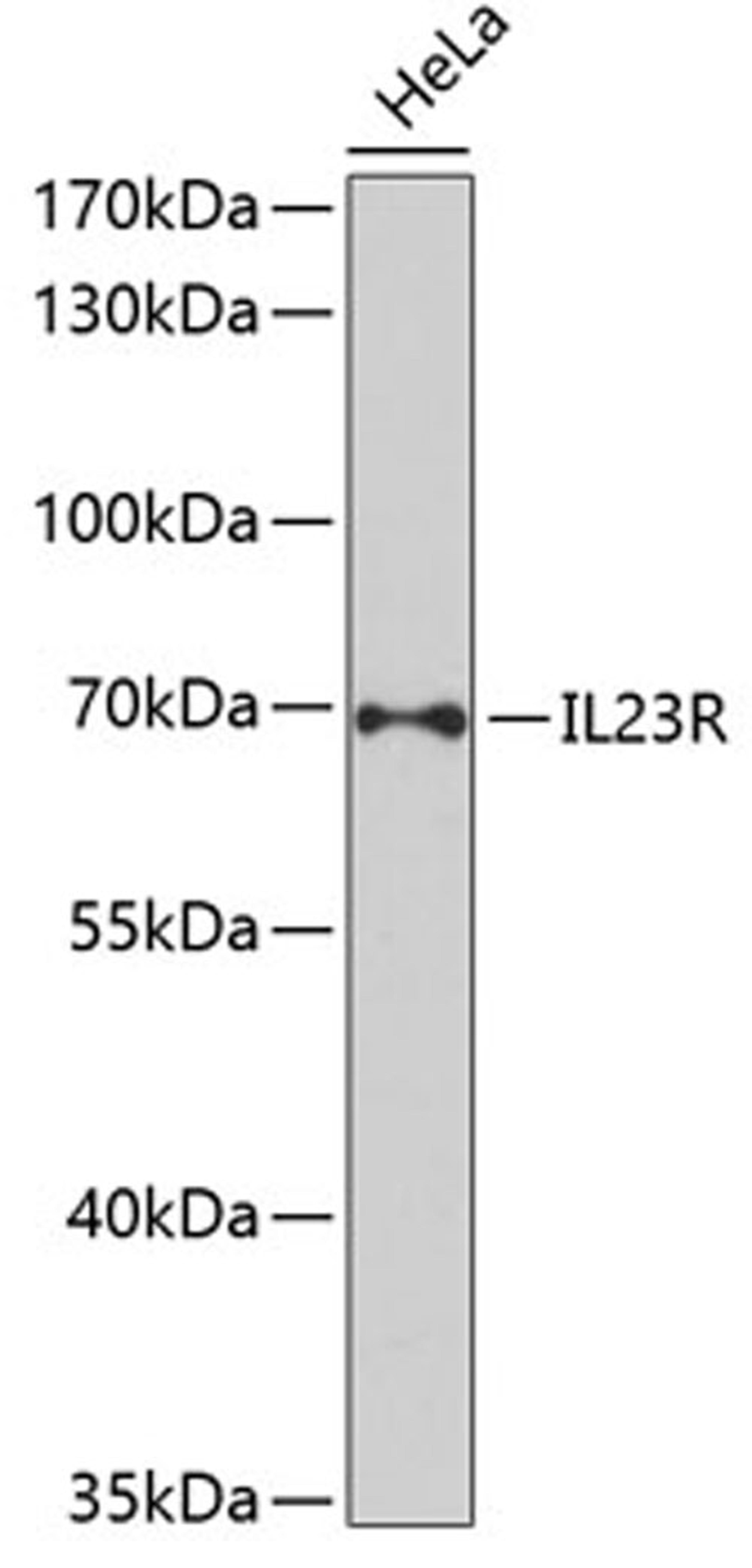 Western blot - IL23R antibody (A1613)