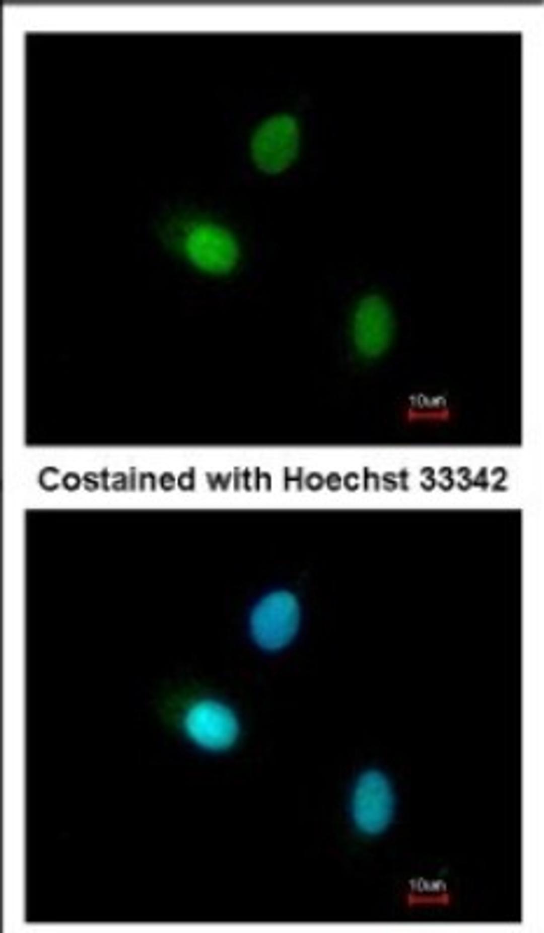 Immunocytochemistry/Immunofluorescence: HUNK Antibody [NBP2-16904] - Immunofluorescence analysis of paraformaldehyde-fixed A549, using antibody at 1:200 dilution.