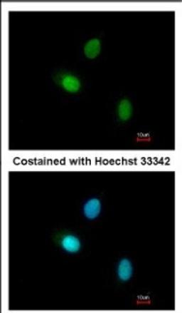 Immunocytochemistry/Immunofluorescence: HUNK Antibody [NBP2-16904] - Immunofluorescence analysis of paraformaldehyde-fixed A549, using antibody at 1:200 dilution.