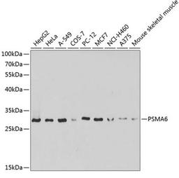 Western blot - PSMA6 antibody (A13536)