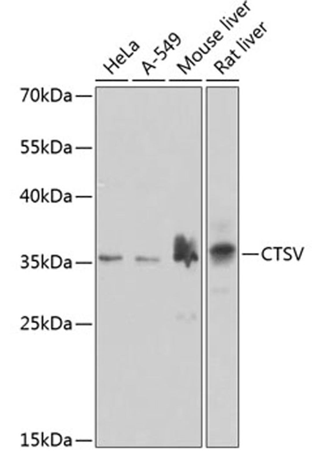 Western blot - CTSV antibody (A7662)