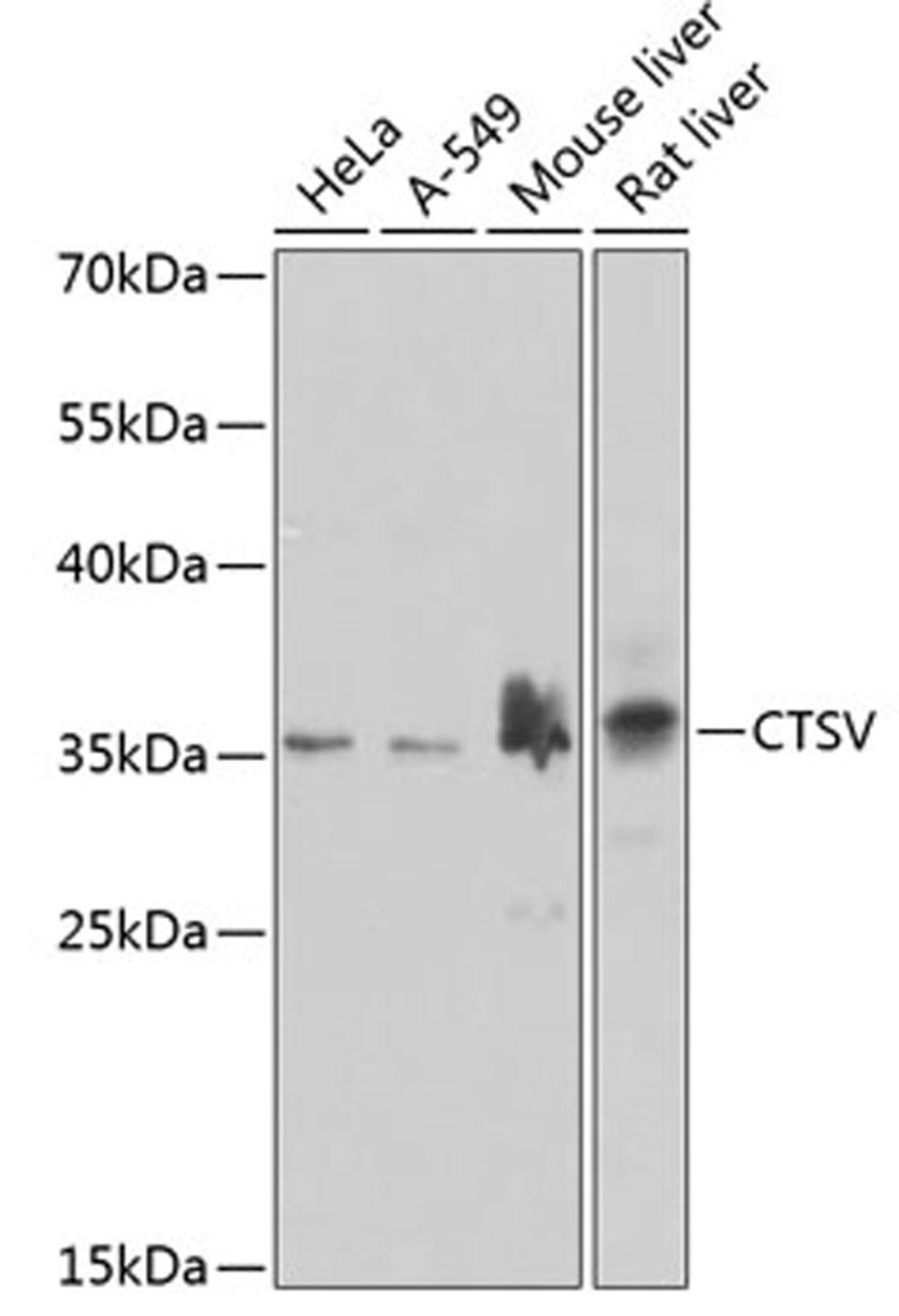 Western blot - CTSV antibody (A7662)