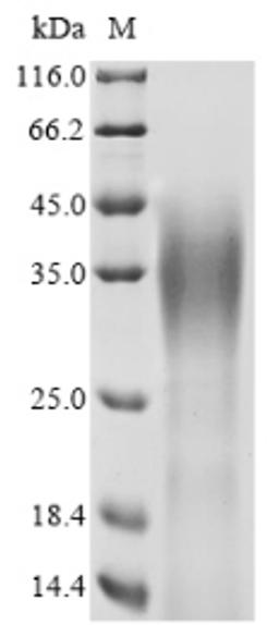 (Tris-Glycine gel) Discontinuous SDS-PAGE (reduced) with 5% enrichment gel and 15% separation gel.